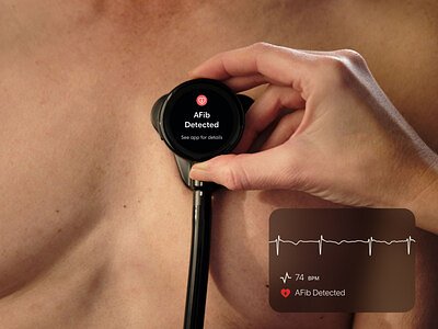 AI Stethoscopes Boost Heart Disease Detection in Landmark NHS Trial