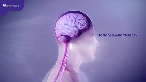 Alpheus Medical Advances Sound-Activated Brain Cancer Therapy Trial