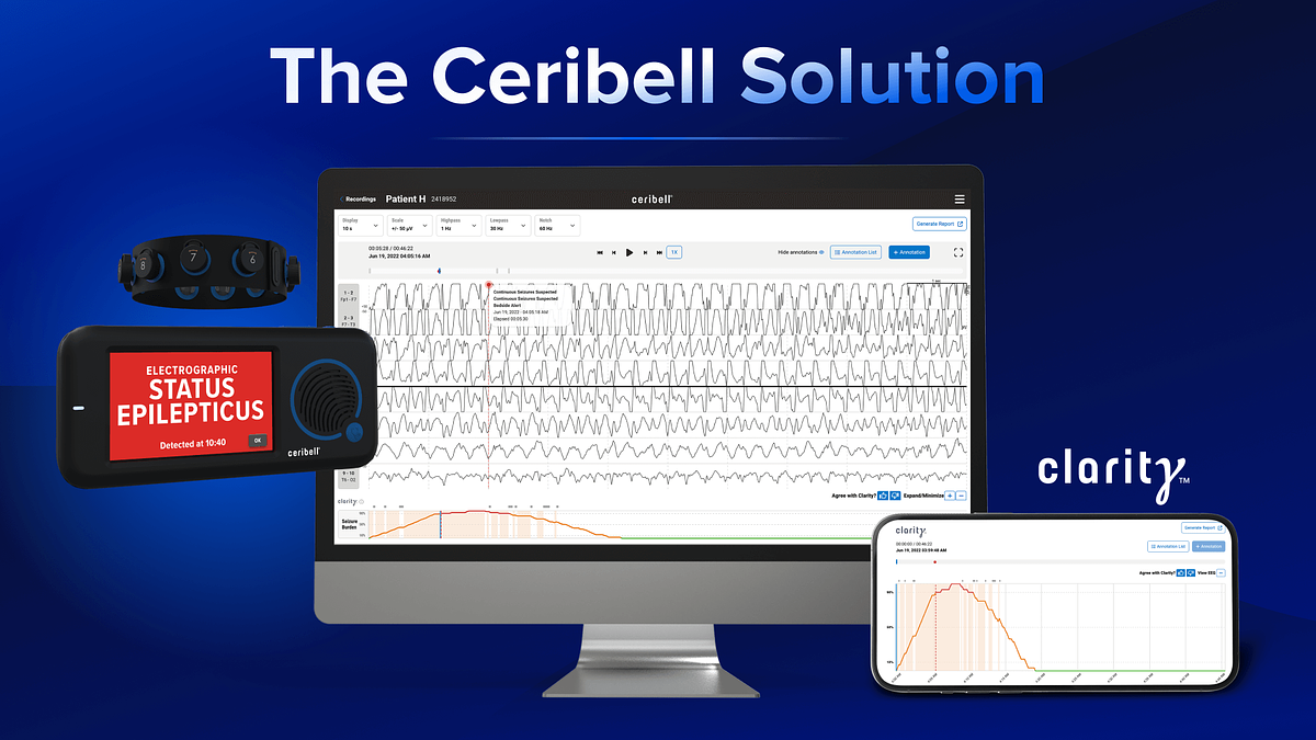 Ceribell to Spotlight AI Brain Monitoring at J.P. Morgan Conference