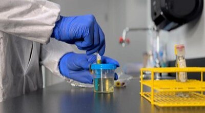 BD's New Urine Kit Aims to Fix a Critical Flaw in Diagnostics