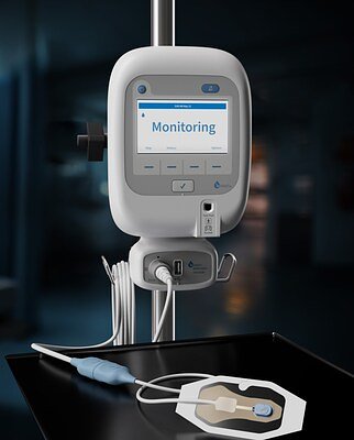 IV Injury Costs Exposed: New Model Shows Millions in Hospital Savings