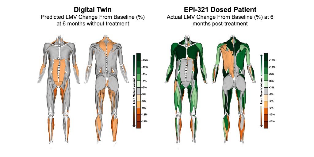 Epicrispr's Gene Silencing Tech Flips the Script on Muscle Wasting