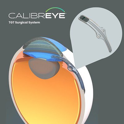 New Era for Glaucoma Care? Adjustable Implant Begins US Trials