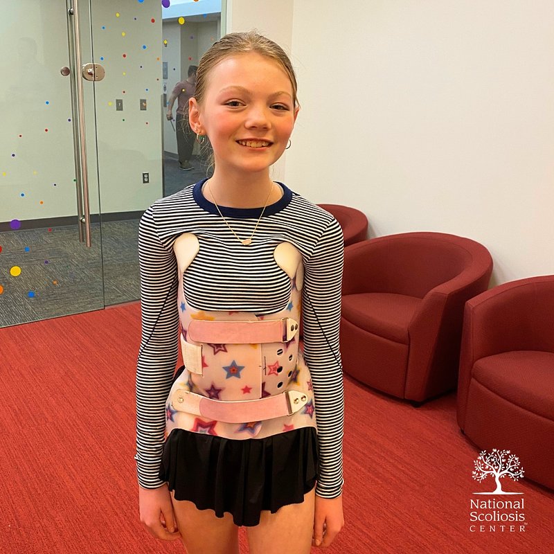 Beyond Halting the Curve: How 3D Bracing Is Redefining Scoliosis Treatment