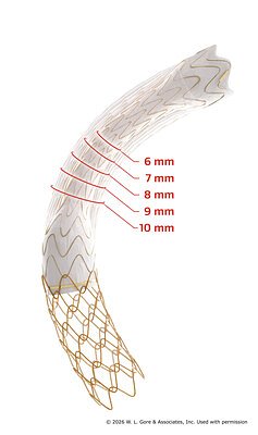 Gore's New TIPS Device Gets CE Mark, Heralding Precision Liver Care