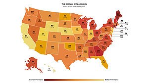 America's Osteoporosis Crisis: A Systemic Breakdown Exposed by Data