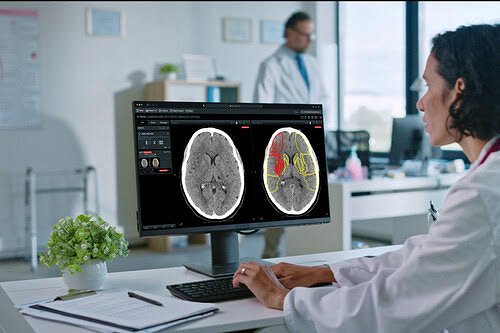 AI's Lifesaving Impact: Brainomix Doubles Stroke Treatment Rates in NHS