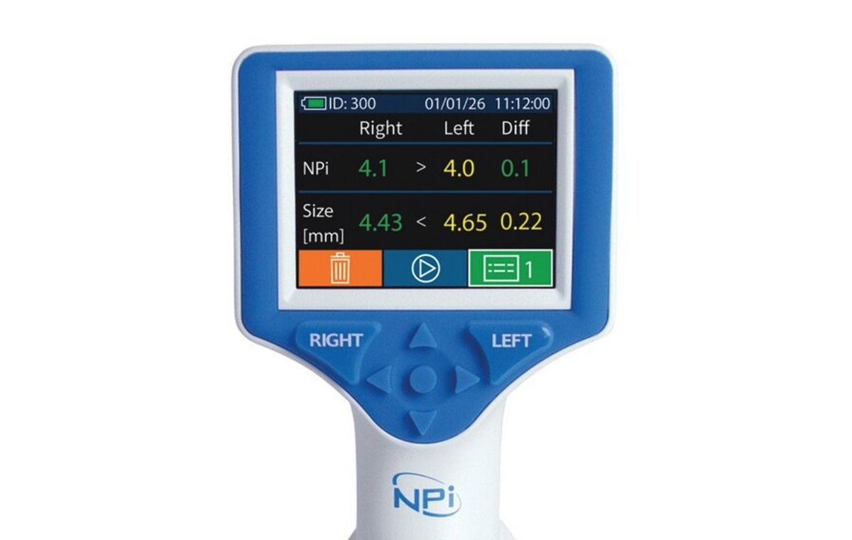 The Automated Eye: Tech Revolutionizes Neurocritical Care Assessment