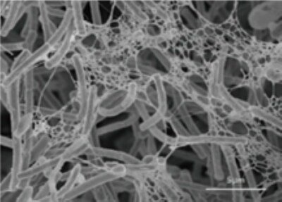 Could a Probiotic Yogurt Boost Lung Cancer Immunotherapy?