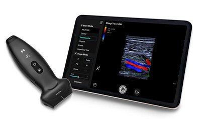 Portable Ultrasound Gains Traction: Mindray's New Device Disrupts Point-of-Care Imaging