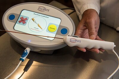 Ellipsys System Returns, Offering Less Invasive Dialysis Access Option