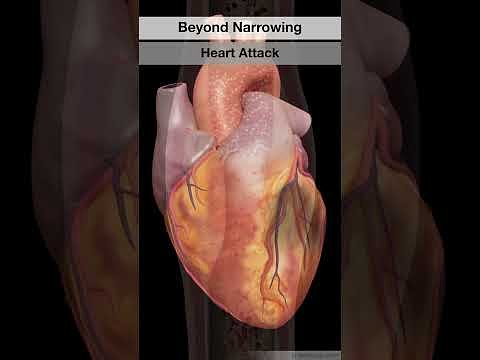 Medmovie's HxHeart.com: Visualizing a New Era in Patient Health
