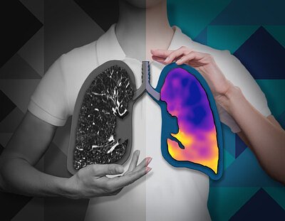 4DMedical's AI Lung Scan Wins EU Approval, Backed by AU$83M War Chest