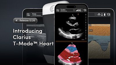 AI Tool Aims to Give Family Doctors a Specialist's Eye for Ultrasound