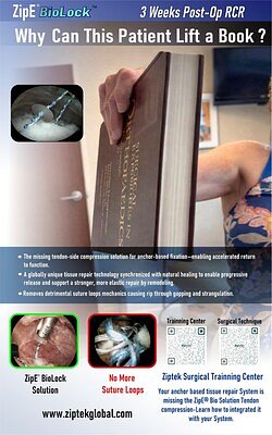 Ziptek’s Biolock Aims to Remodel the Tissue Repair Market