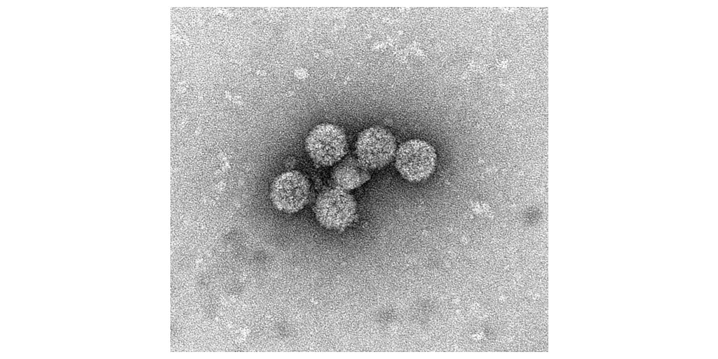 Orthogon's $36M War Chest to Fight a Devastating Transplant Virus