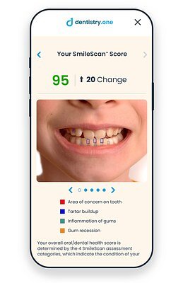 AI Tool Targets Dental Care Gap for Underserved US Children