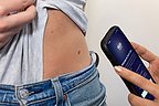 Smartphone AI Earns Top Medical Mark to Fight Skin Cancer