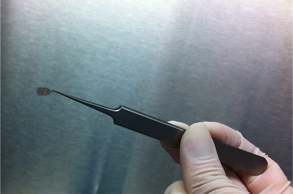 RPT's Stem Cell Implant: A Growth Signal in the Fight for Sight