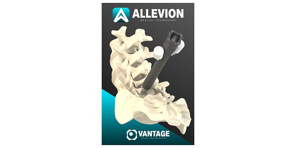 Allevion's Vantage™ Kit Gets FDA Nod, Eyes Spine Surgery Revolution