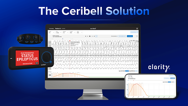 Ceribell to Spotlight AI Brain Monitoring at J.P. Morgan Conference