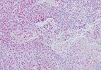 New Automated Platform to Revolutionize RNA Tissue Analysis