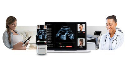 At-Home Ultrasound Gains FDA Approval, Promising Broader Access to Prenatal Care