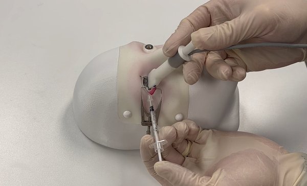 New Gene Therapy for Dry AMD Completes Key Human Safety Trial