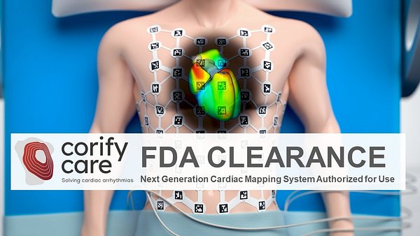 Corify Care's 4D Heart Mapping Tech Earns FDA Clearance