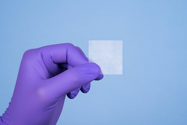 New Hope for Diabetic Wounds: Allograft Triples Healing Rates in Study