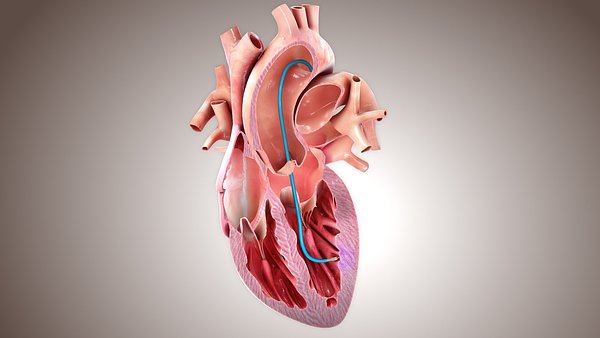 BioCardia Advances Key Device for Precision Heart Treatment
