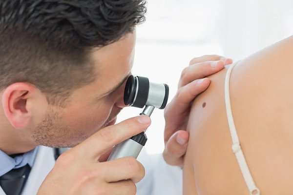 Skin Cancer Crisis Hits Parliament Hill Amid Dermatologist Shortage