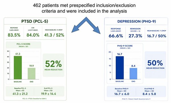 Deep TMS Shows Unprecedented Response in Complex PTSD and Depression