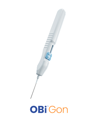 Hexiris Signals the End of the OR's Stranglehold on Glaucoma Care