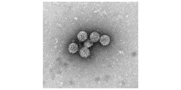 Orthogon's $36M War Chest to Fight a Devastating Transplant Virus